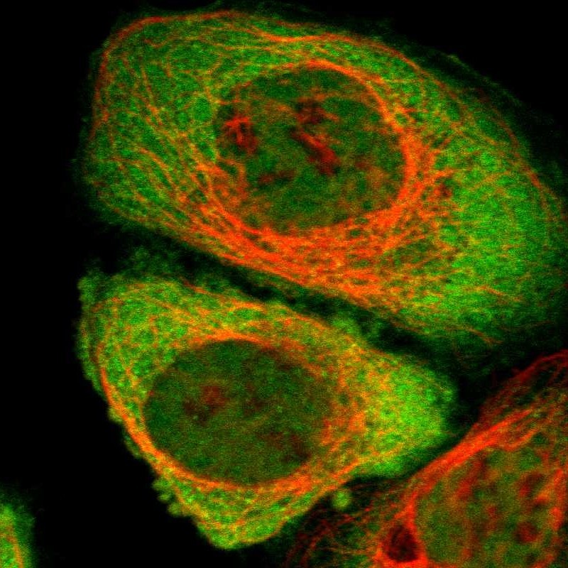 Staining of human cell line A-431 shows localization to nucleoplasm & cytosol.