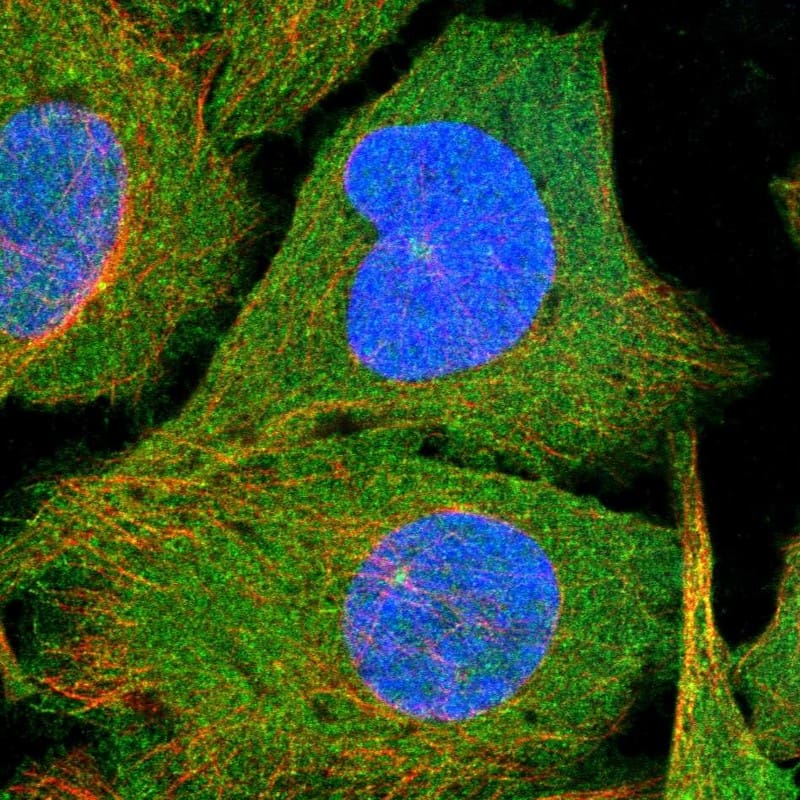 Staining of human cell line U-2 OS shows localization to plasma membrane & centrosome.