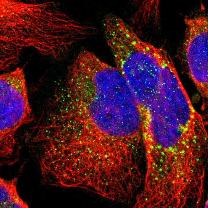 Staining of human cell line U-2 OS shows localization to vesicles.