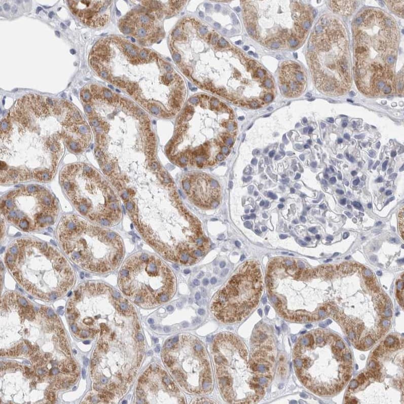 Staining of human kidney shows strong cytoplasmic positivity in cells in tubules.