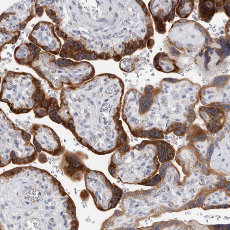 Staining of human placenta shows strong cytoplasmic positivity in trophoblastic cells.
