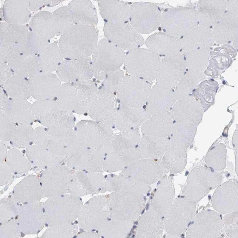 Staining of human skeletal muscle shows no positivity in myocytes as expected.