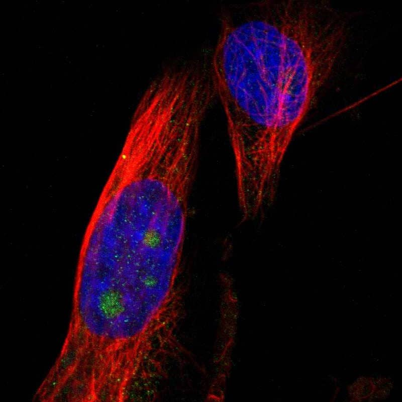 Staining of human cell line U-251 MG shows localization to nucleoli.