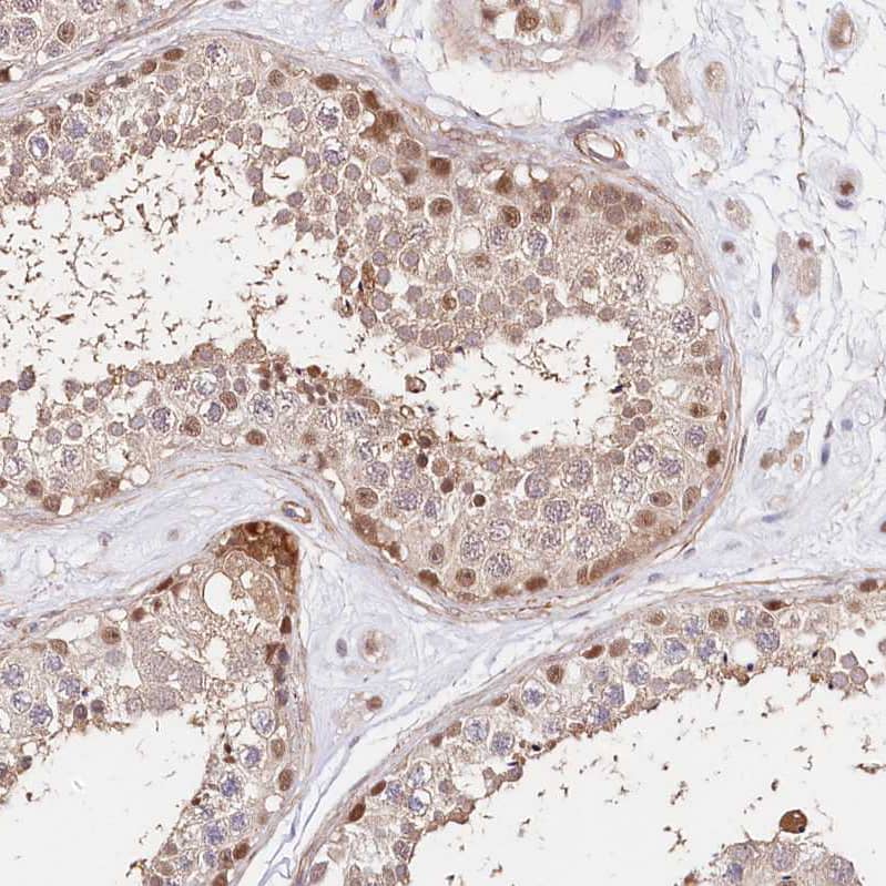Immunohistochemistry-Paraffin PPP2R5B Antibody - BSA Free