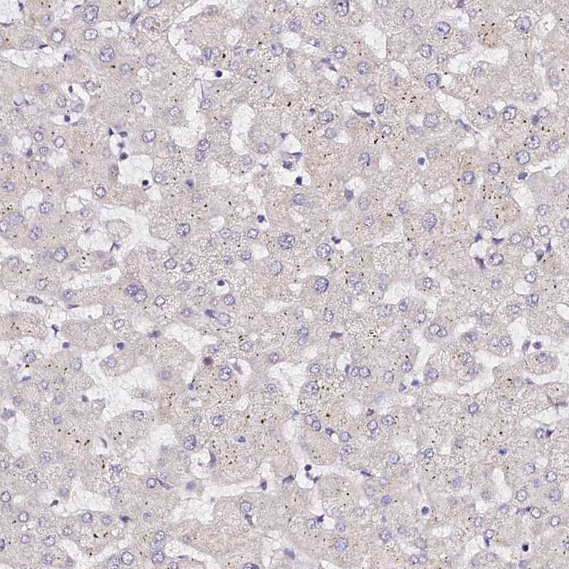 Immunohistochemistry-Paraffin PPP2R5B Antibody - BSA Free