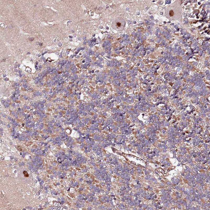 Immunohistochemistry-Paraffin PPP2R5B Antibody - BSA Free