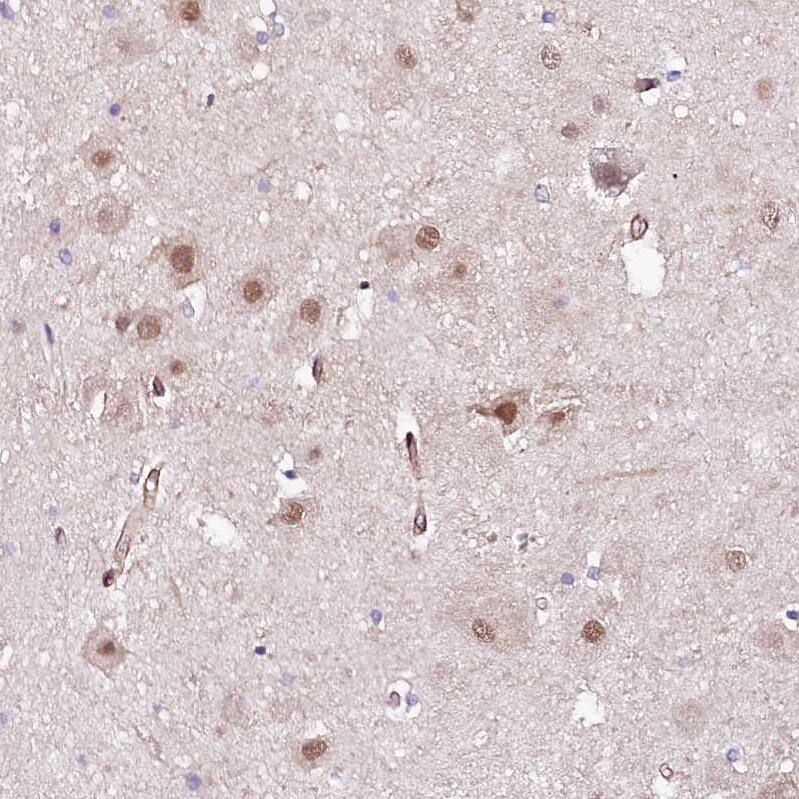 Immunohistochemistry-Paraffin PPP2R5B Antibody - BSA Free