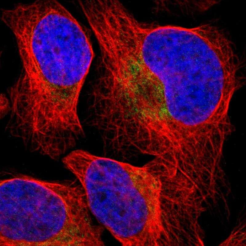 Staining of human cell line U-2 OS shows localization to cytosol.