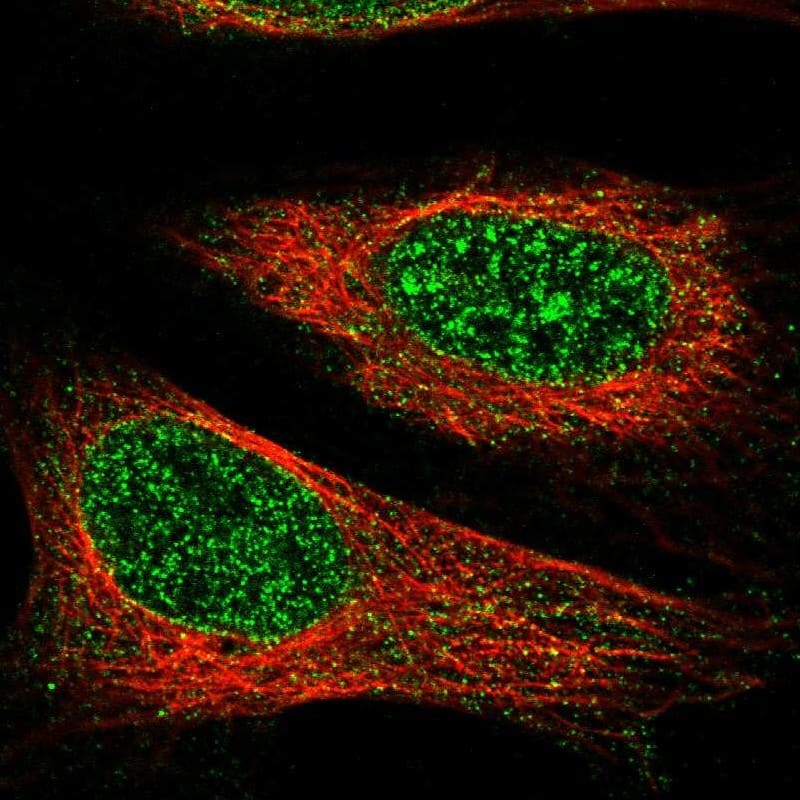 Staining of human cell line U-2 OS shows localization to nucleoplasm & nuclear membrane.