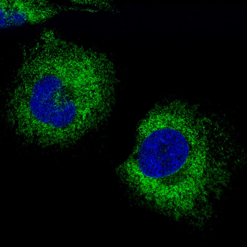 Staining of human cell line RH-30 shows localization to endoplasmic reticulum.