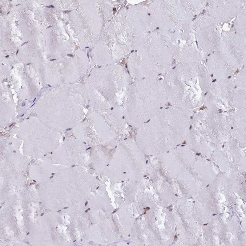 Staining of human skeletal muscle shows no positivity in myocytes.