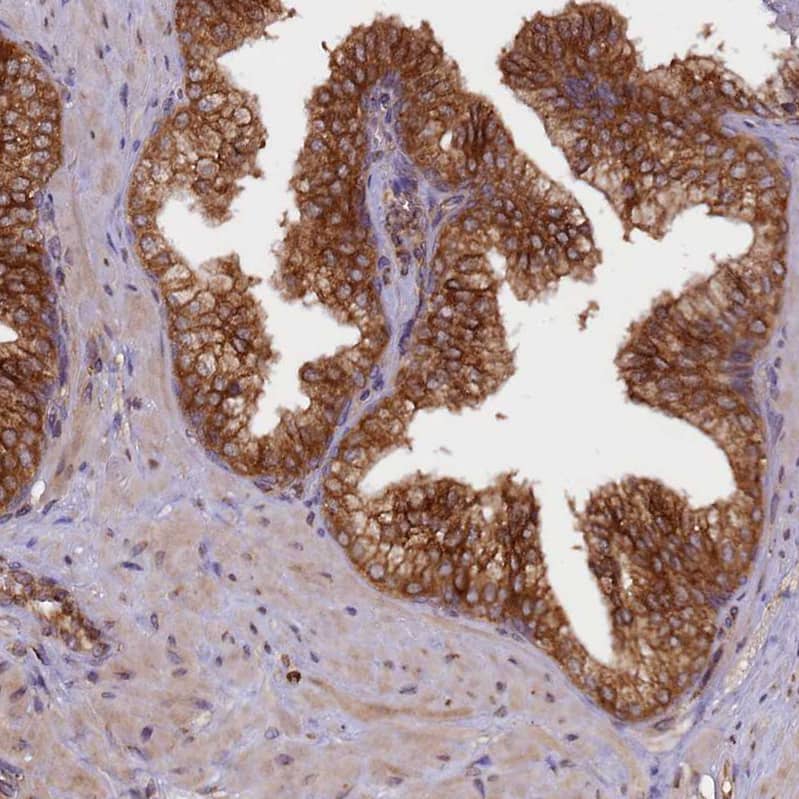 Staining of human prostate shows strong cytoplasmic positivity in glandular cells.
