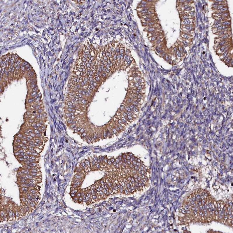 Staining of human endometrium shows strong cytoplasmic positivity in glandular cells.