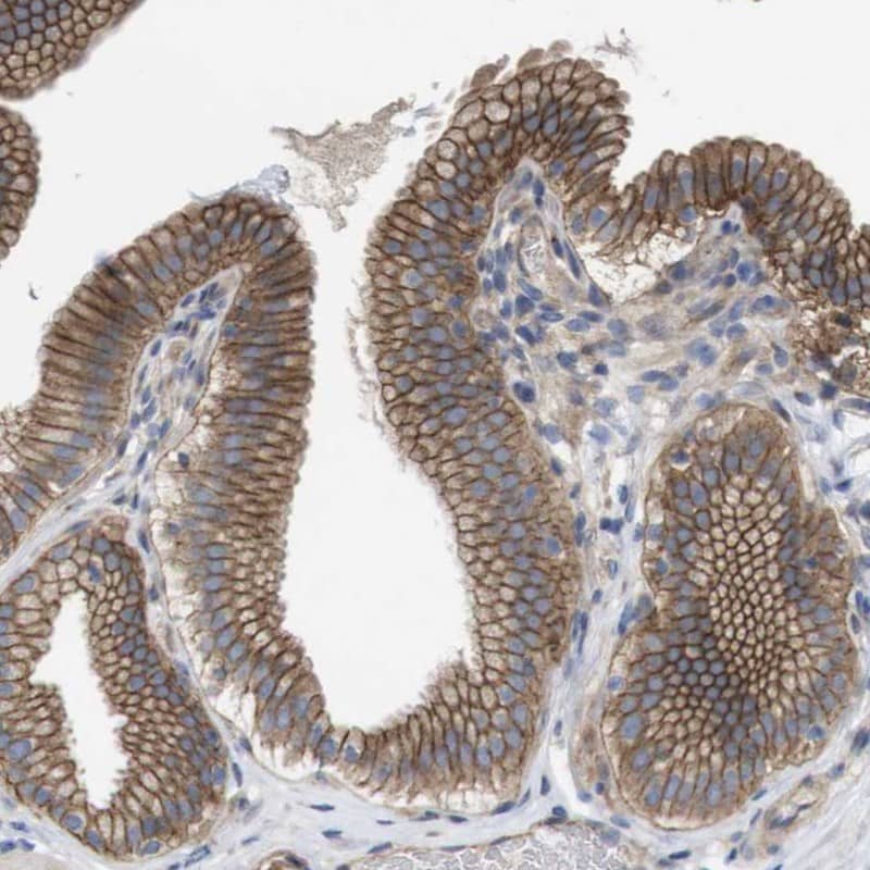 Immunohistochemistry-Paraffin KIDINS220 Antibody - BSA Free