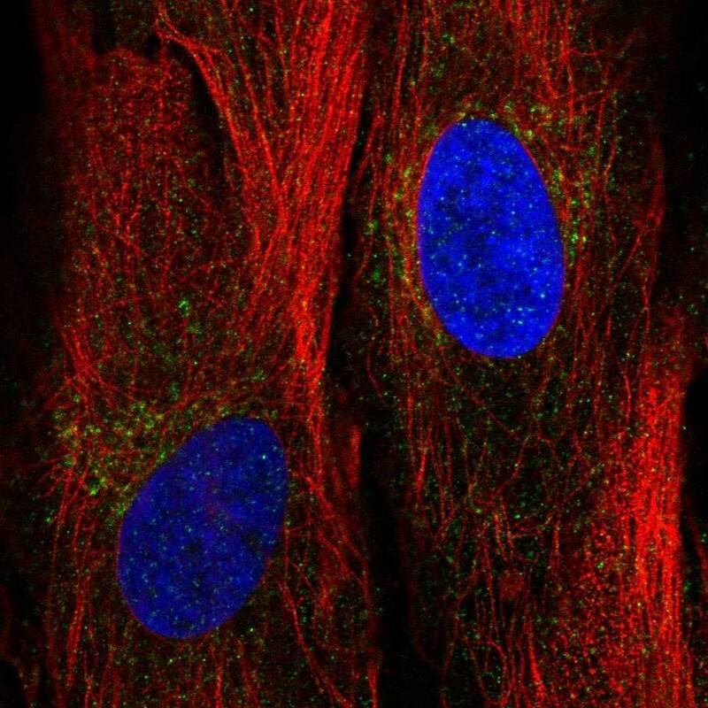 Staining of human cell line BJ shows localization to the Golgi apparatus.