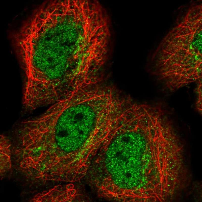 Staining of human cell line A-431 shows localization to nucleoplasm & the Golgi apparatus.
