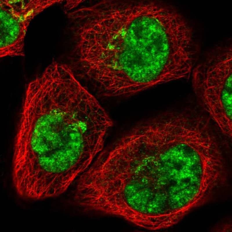 Staining of human cell line A-431 shows localization to nuclear speckles & the Golgi apparatus.