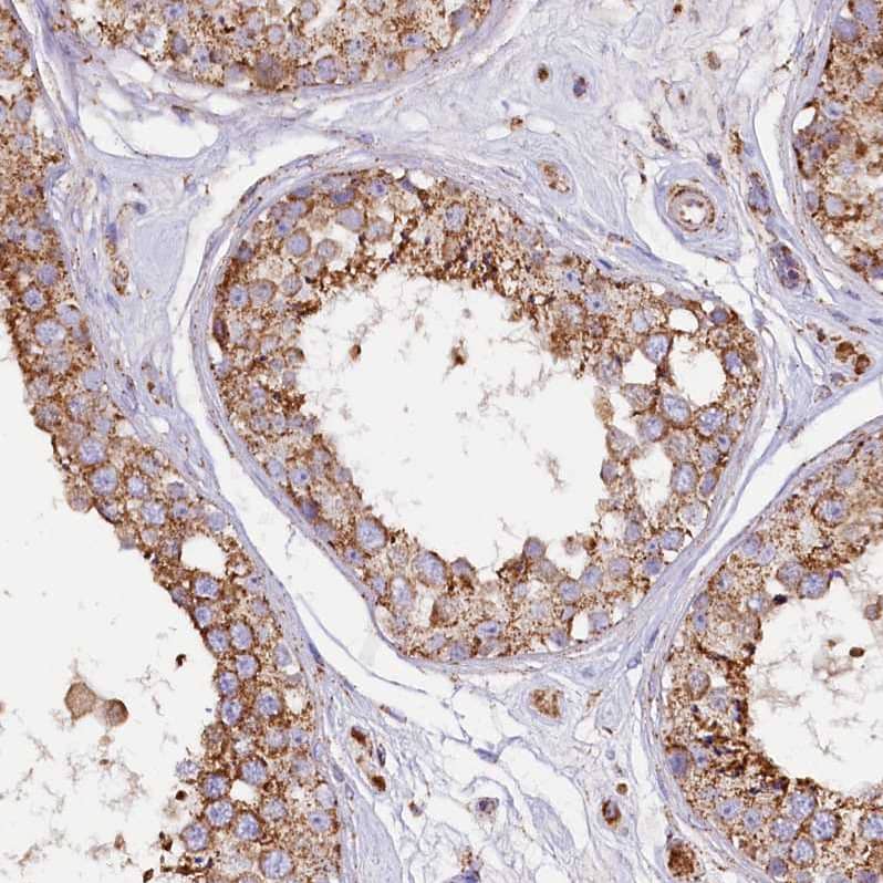 Immunohistochemistry-Paraffin APLP-2 Antibody - BSA Free