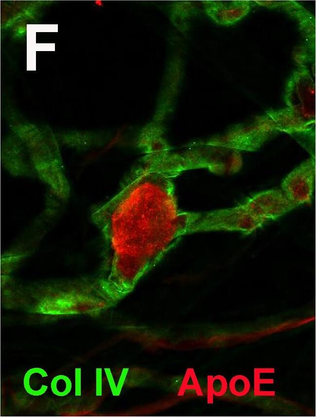 Staining of vascular BM whole mounts with antibodies to proteins detected in the proteome analysis.A generic staining of the vascular BMs was given by an antibody to the 7S domain of collagen IV  alpha 3 (A, C, E, F, G). Prominent staining for microvascular aneurisms was detected by staining with antibodies to C9 (B, C), Fibronectin (FN, E), ApoE (F) and PRELP (G). The same treatment of vascular BM whole mounts from non-diabetic eyes did not show staining for these proteins (D). A norrin-specific staining is shown to be generic for the entire vascular BM whole mounts (H), the signal, however, being less prominent in vascular aneurisms (arrow in H). Staining of vascular BM whole mounts from non-diabetic eyes showed a clearly weaker staining for norrin, when compared to vascular whole mounts from non-diabetic donors. Bar: 25um. Image collected and cropped by CiteAb from the following open publication (//pubmed.ncbi.nlm.nih.gov/29284024), licensed under a CC-BY license. Not internally tested by Novus Biologicals.