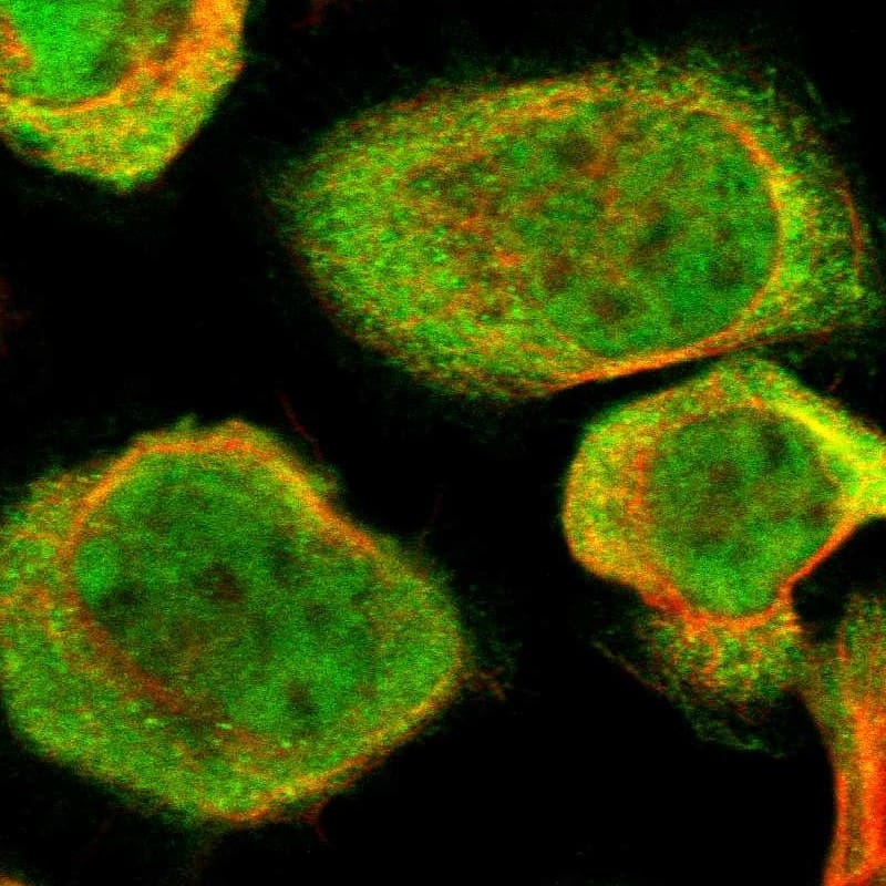 Staining of human cell line A-431 shows localization to nucleoplasm & cytosol.