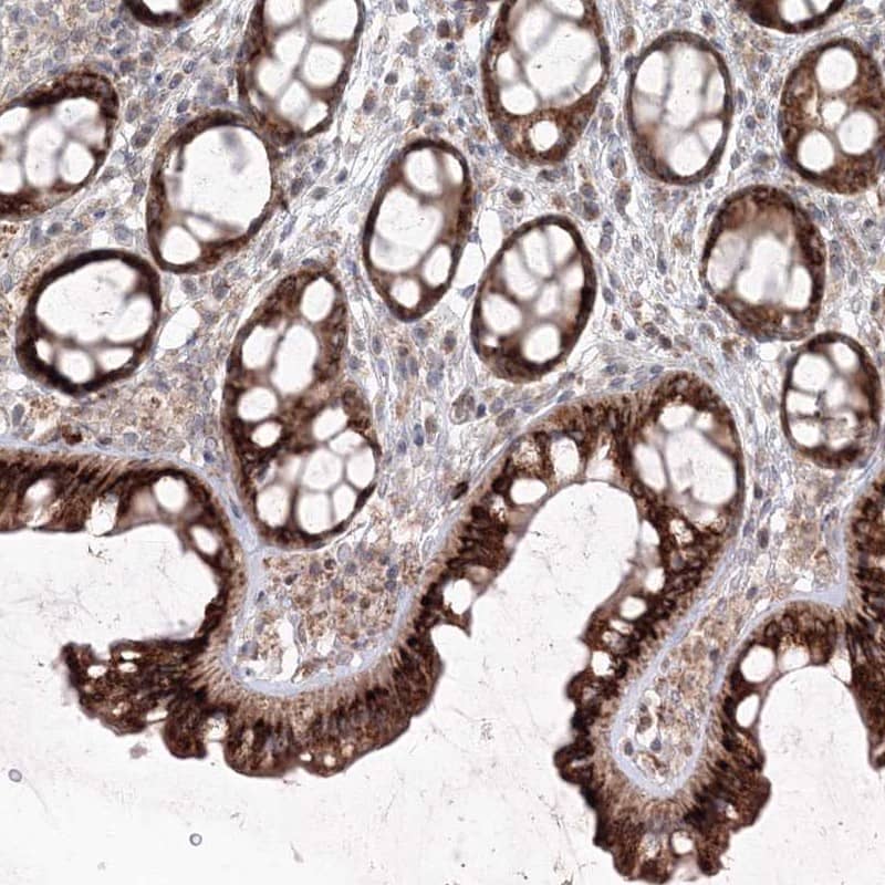 Staining of human colon shows strong cytoplasmic positivity in glandular cells.
