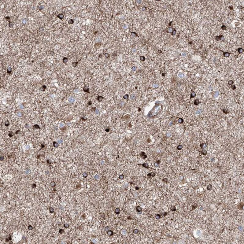 Staining of human cerebral cortex shows strong cytoplasmic positivity in glial cells.