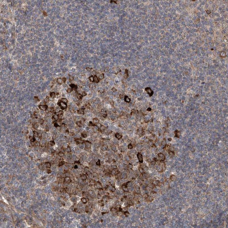 Staining of human lymph node shows moderate to strong cytoplasmic positivity in germinal center cells.