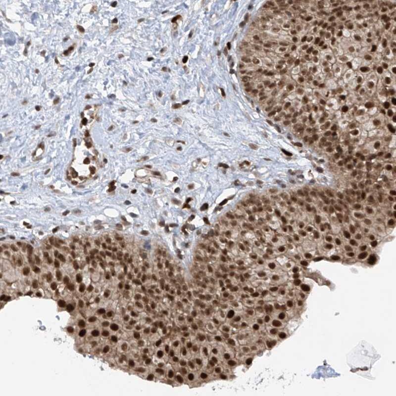 Staining of human urinary bladder shows distinct nuclear positivity in urothelial cells.