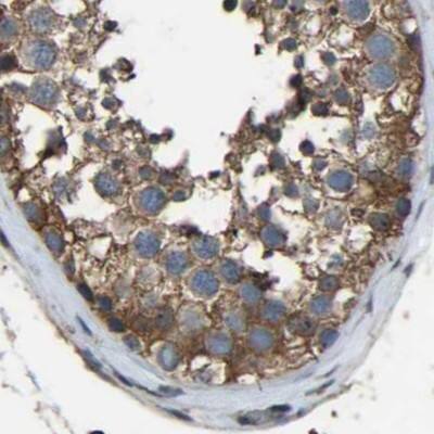 Staining of human testis.