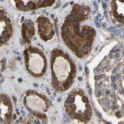 Staining of human kidney.