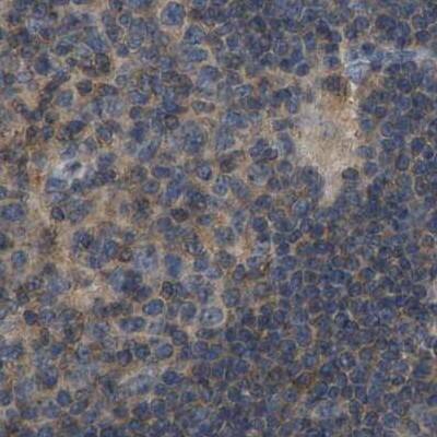 Staining of human lymph node.