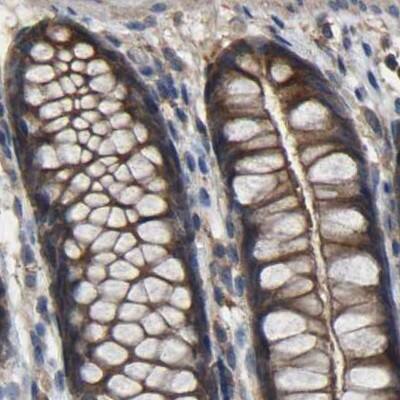 Staining of human colon.