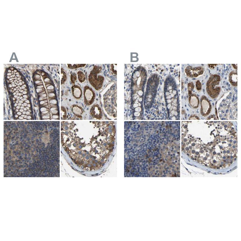 <b>Orthogonal Strategies Validation. </b>Staining of human colon, kidney, lymph node and testis HPA018909 (A) shows similar protein distribution across tissues to independent antibody HPA018840 (B).