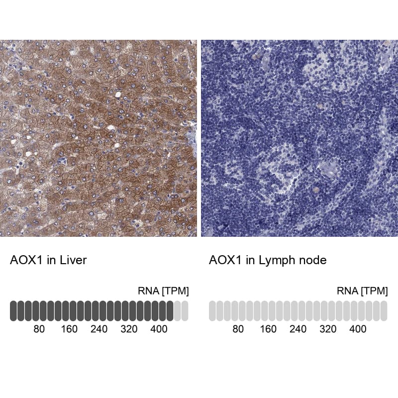 Immunohistochemistry-Paraffin Aldehyde Oxidase 1/AOX1 Antibody - BSA Free