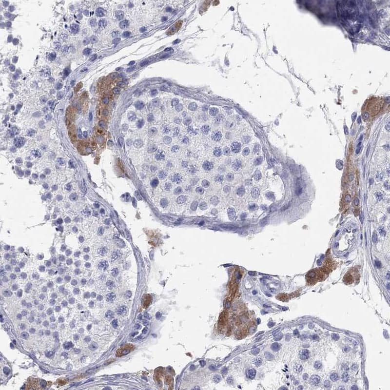 Immunohistochemistry-Paraffin Aldehyde Oxidase 1/AOX1 Antibody - BSA Free