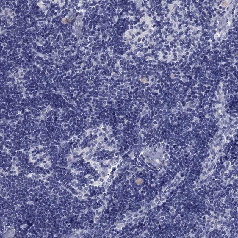 Immunohistochemistry-Paraffin Aldehyde Oxidase 1/AOX1 Antibody - BSA Free