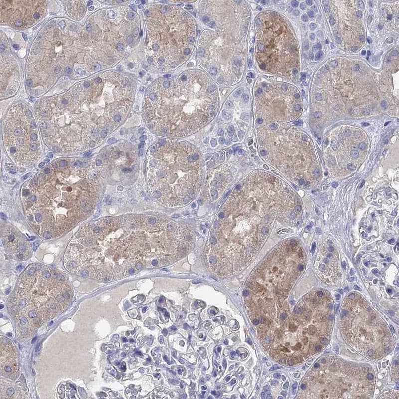 Immunohistochemistry-Paraffin Aldehyde Oxidase 1/AOX1 Antibody - BSA Free