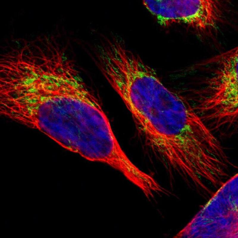 Immunocytochemistry/ Immunofluorescence SLC25A31 Antibody - BSA Free