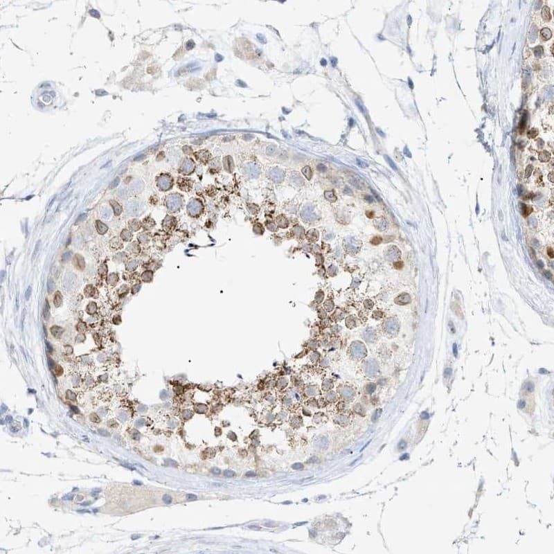 Immunohistochemistry-Paraffin SLC25A31 Antibody - BSA Free