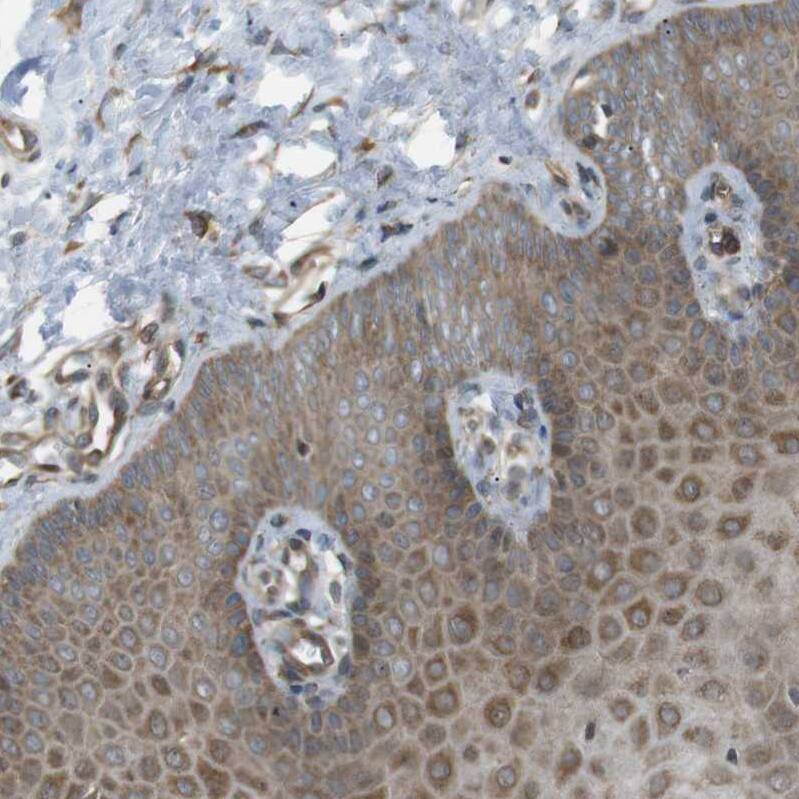 Immunohistochemical staining of human cervix shows moderate cytoplasmic positivity in squamous epithelial cells and smooth muscle cells.