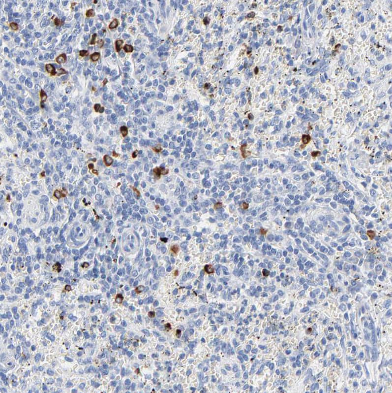 Immunohistochemical staining of human spleen shows strong cytoplasmic positivity in cells in red pulp.
