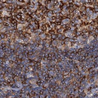 Immunohistochemistry-Paraffin ANKRD13A Antibody - BSA Free