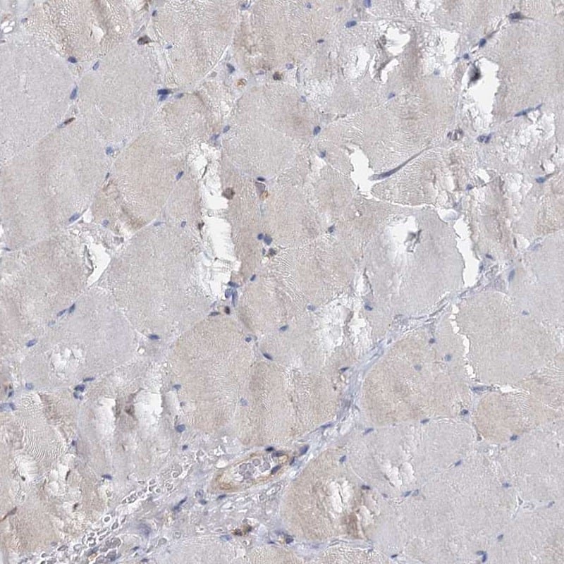 Immunohistochemistry-Paraffin ANKRD13A Antibody - BSA Free