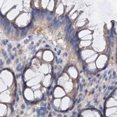Immunohistochemistry-Paraffin ANKRD13A Antibody - BSA Free