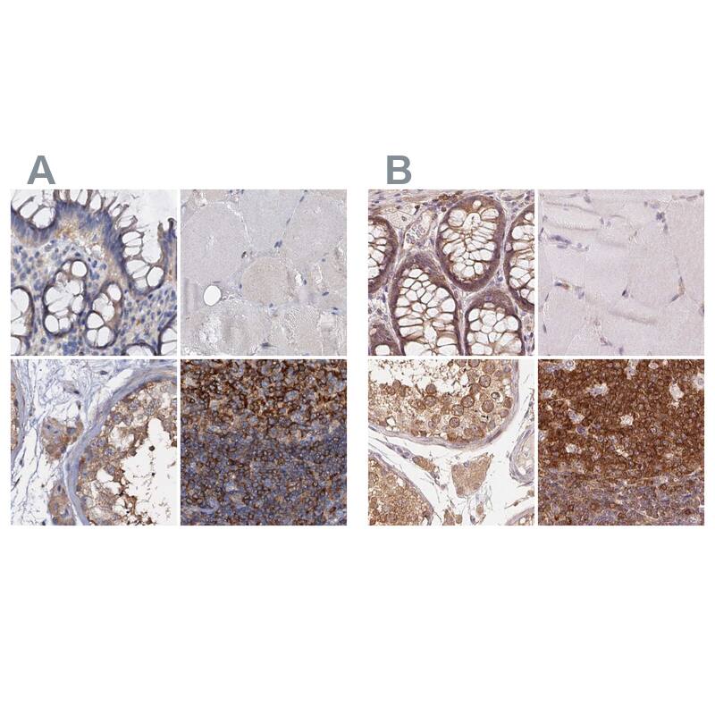 Immunohistochemistry-Paraffin ANKRD13A Antibody - BSA Free