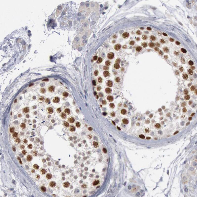 Staining of human testis shows strong nuclear positivity in cells in seminiferous ducts.