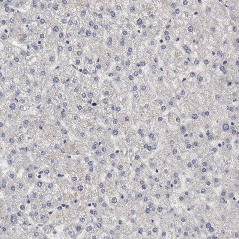 Staining of human liver shows no positivity in hepatocytes as expected.