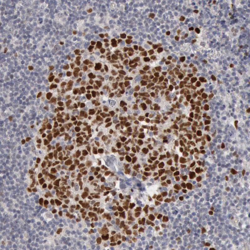 Staining of human lymph node shows strong nuclear positivity in germinal center cells.
