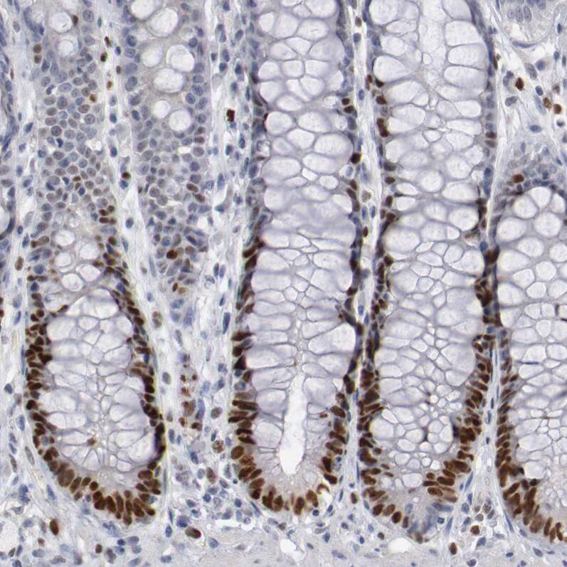 Staining of human rectum shows strong nuclear positivity in glandular cells.