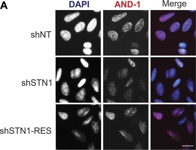 Immunocytochemistry/ Immunofluorescence: WDHD1 Antibody [NBP1-89091] - CST is required for AND-1 & pol  alpha  chromatin association.(A) Representative images of pre-extracted HeLa cells used to measure chromatin-associated AND-1. DAPI: blue, AND-1: red. Scale bar = 12.5 μm. (B) Dot plots of mean AND-1 intensity per nuclei in AFU for each cell line, as indicated. Black line & numbers below the graph indicate the mean AFU. Error bars indicate the ±SEM of three independent biological experiments. (C) Western blot analysis showing chromatin fractions from HCT116 cells. Ponceau S & histone H3 were used as loading controls. AND-1 & pol  alpha  levels were normalized to H3 levels & then normalized to the shNT control. (D) Co-IP was performed with Flag or HA antibody in cell lysates from HEK 293T cells, as indicated. 5% input was loaded as a control. For +HU samples in (B) & (D), HU was added 2 h before collection. Data are representative of three independent biological experiments. n indicates the number of total nuclei scored. P-values were calculated by an unpaired, two-tailed Mann–Whitney test in (B) & t test in (C) (****P ≤ 0.0001, **P ≤ 0.01). Image collected & cropped by CiteAb from the following publication (//pubmed.ncbi.nlm.nih.gov/30979824), licensed under a CC-BY license. Not internally tested by Novus Biologicals.